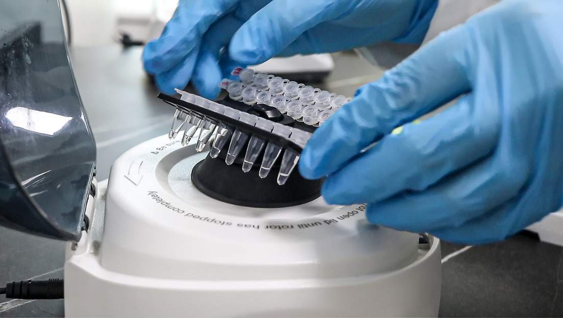 Diagnóstico por PCR-Multiplex